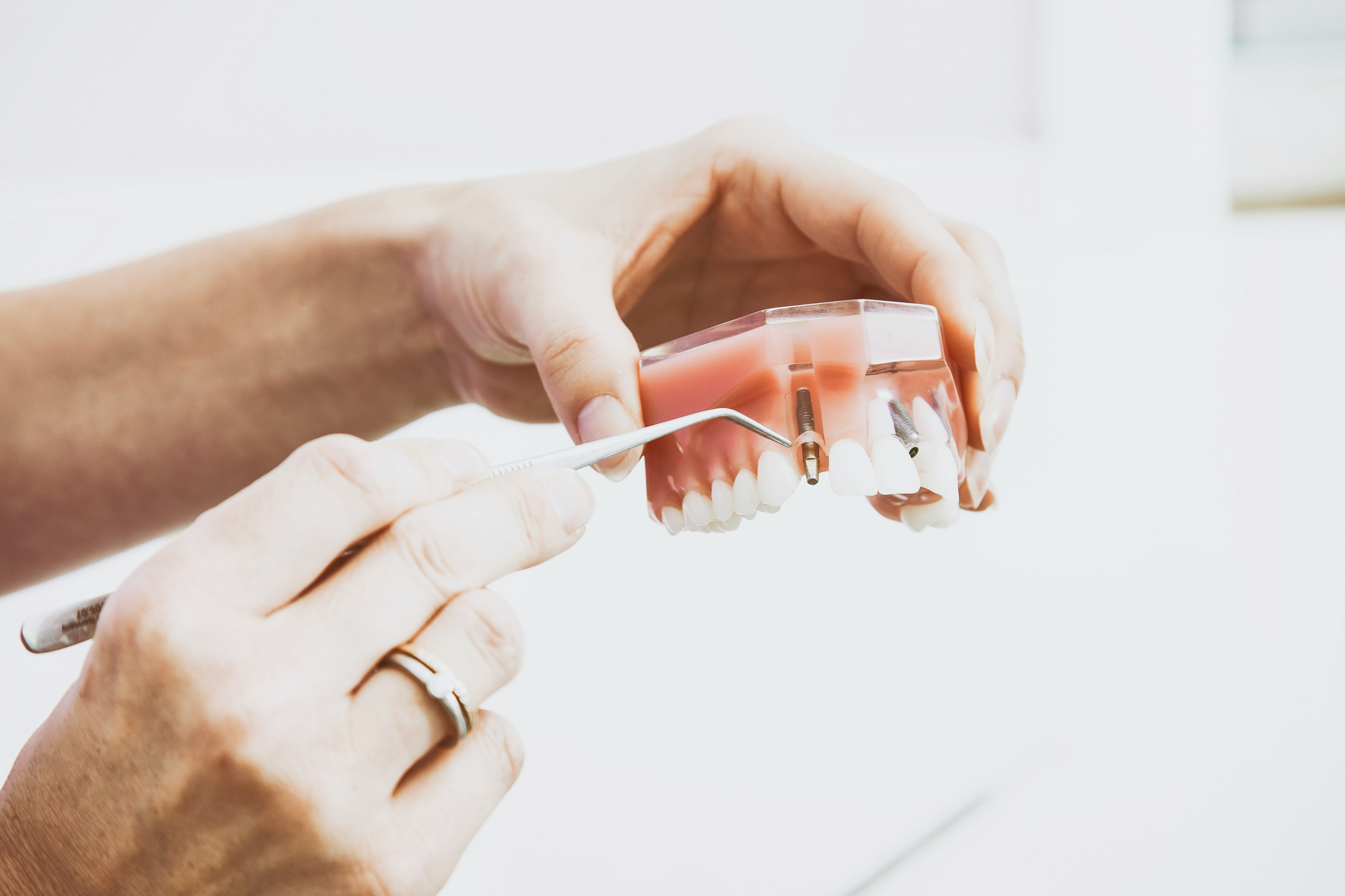 How Do They Do Dental Implants In One Day Hands Holding Dental Implant Model With Visible Implant Screws And Dental Instrument