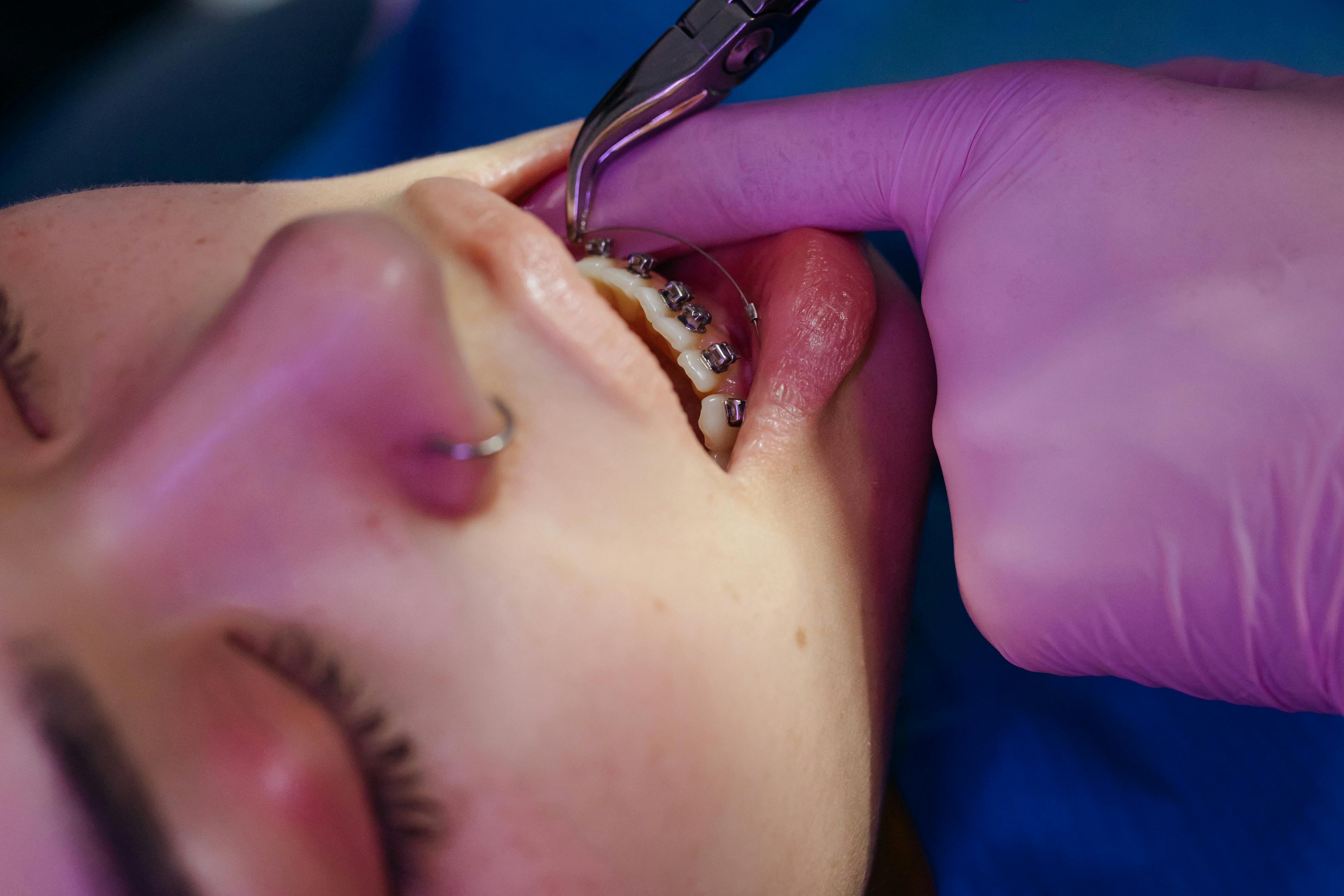 Photo Dentist Adjusting Braces With Tool And Gloved Hand Inside Patient Mouth