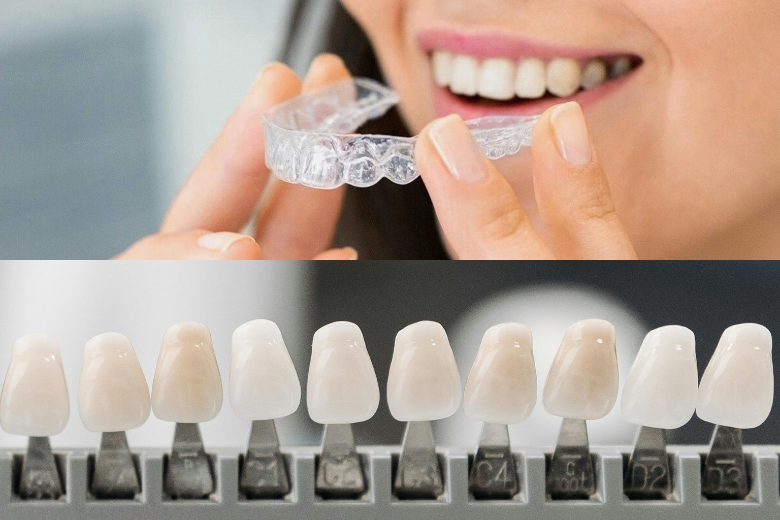 Photo Woman Holding Clear Aligner And Row Of Dental Shade Tabs Displayed For Invisalign Vs Veneers Comparison