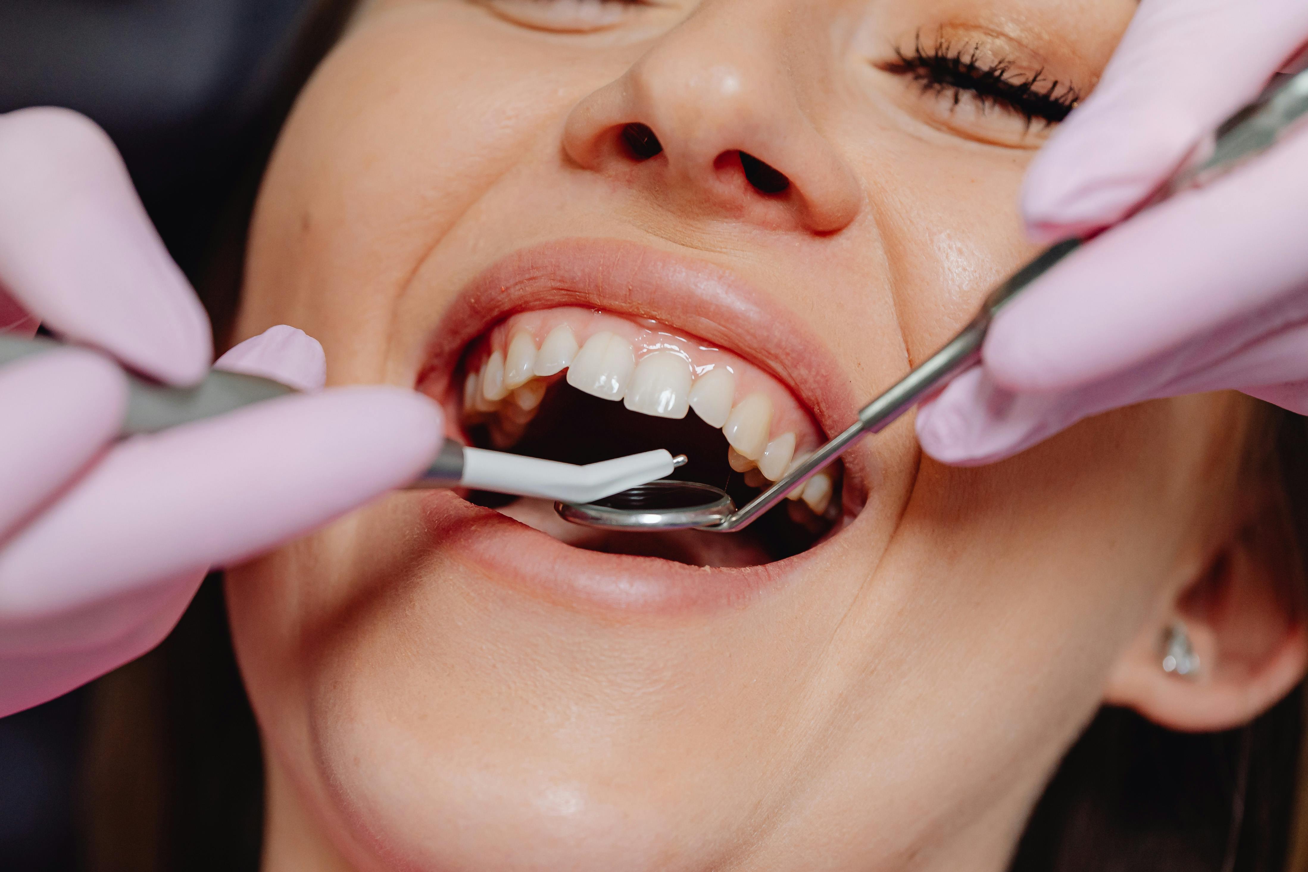 Photo Close Up Of Dentist Examining Woman Teeth With Dental Mirror And Instrument Wearing Pink Gloves