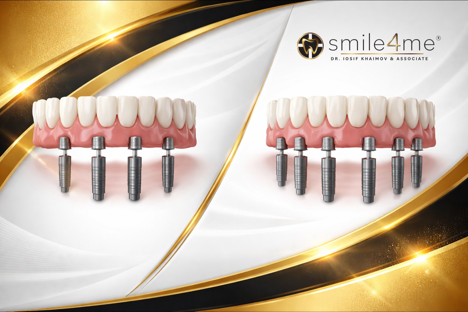 Graphic All On 4 Vs All On 6 Dental Implants With Two Full Arch Prosthetics And Four And Six Implant Posts On White And Gold Background With Smile4me Logo