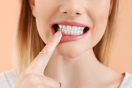 Photo Woman Pointing To Front Veneers During Consultation