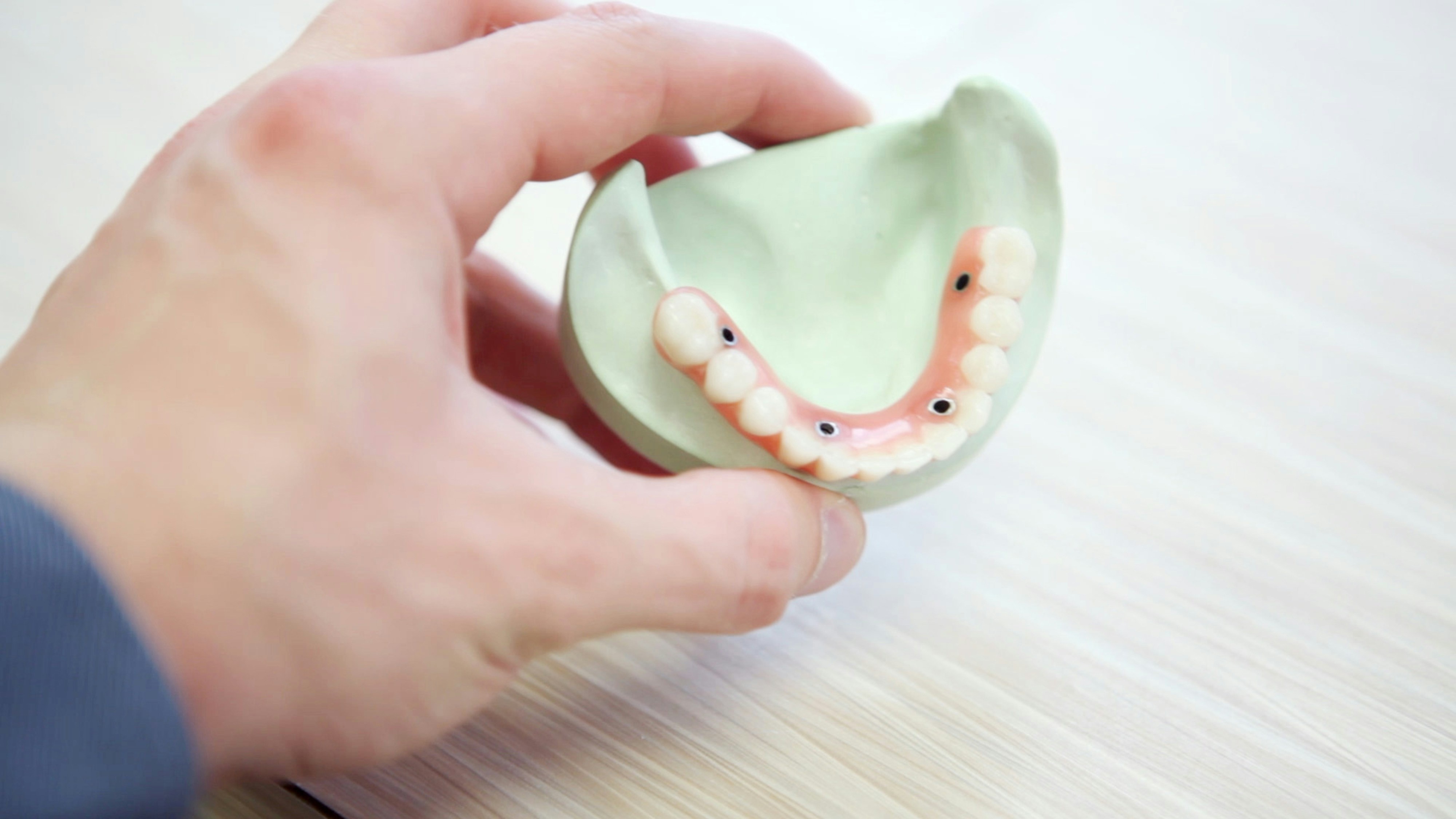 Photo Dental Implants Bridge Model Candidate For Dental Implants