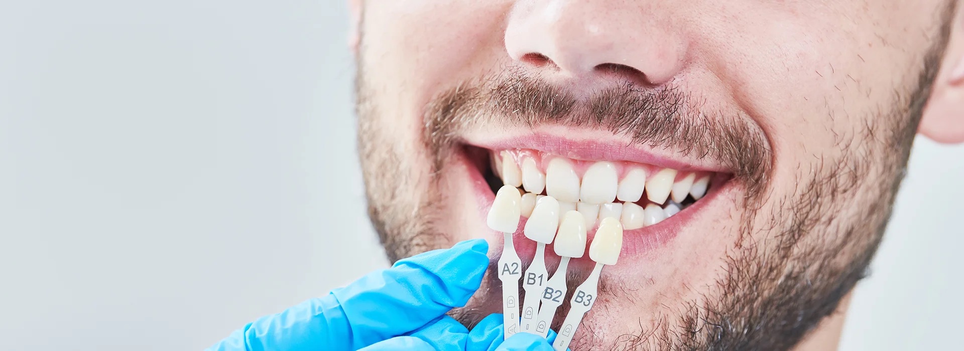 Photo Smiling Man Comparing Teeth Shades Porcelain Vs Composite Veneers