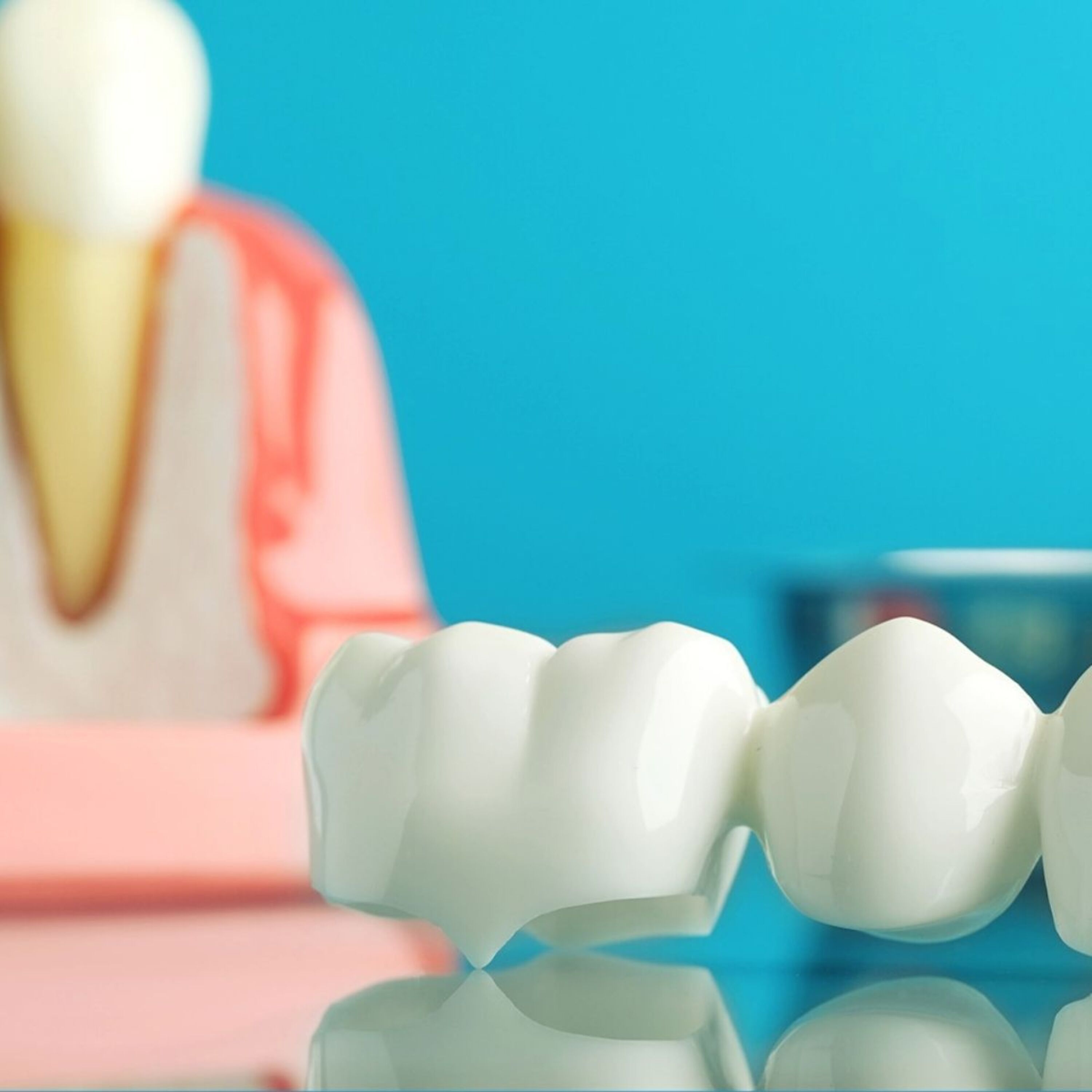 Photo Dental Bridge Beside Tooth Model On Reflective Surface