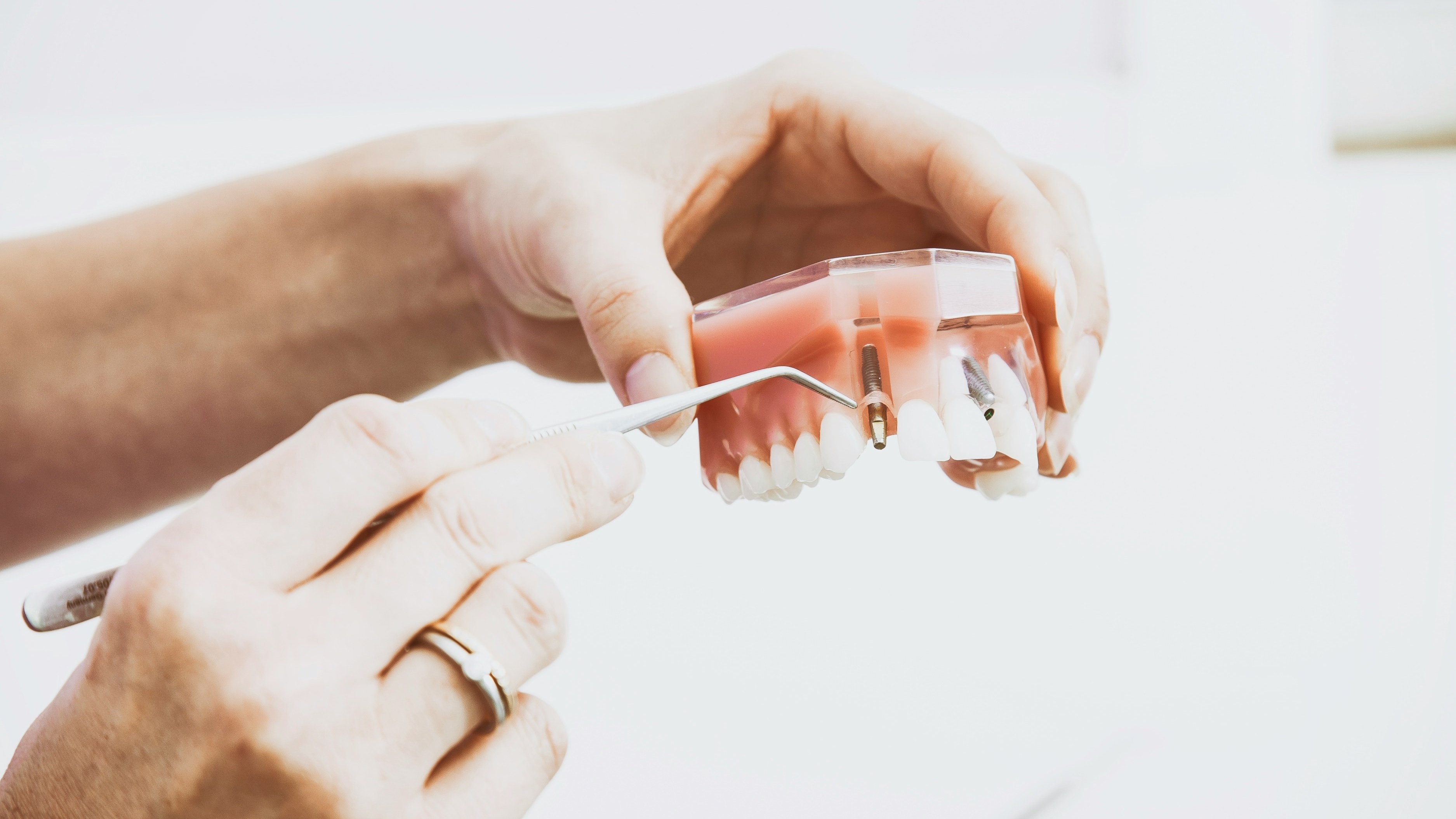 Photo Dentist Holding Dental Implant And Bridge Jaw Model