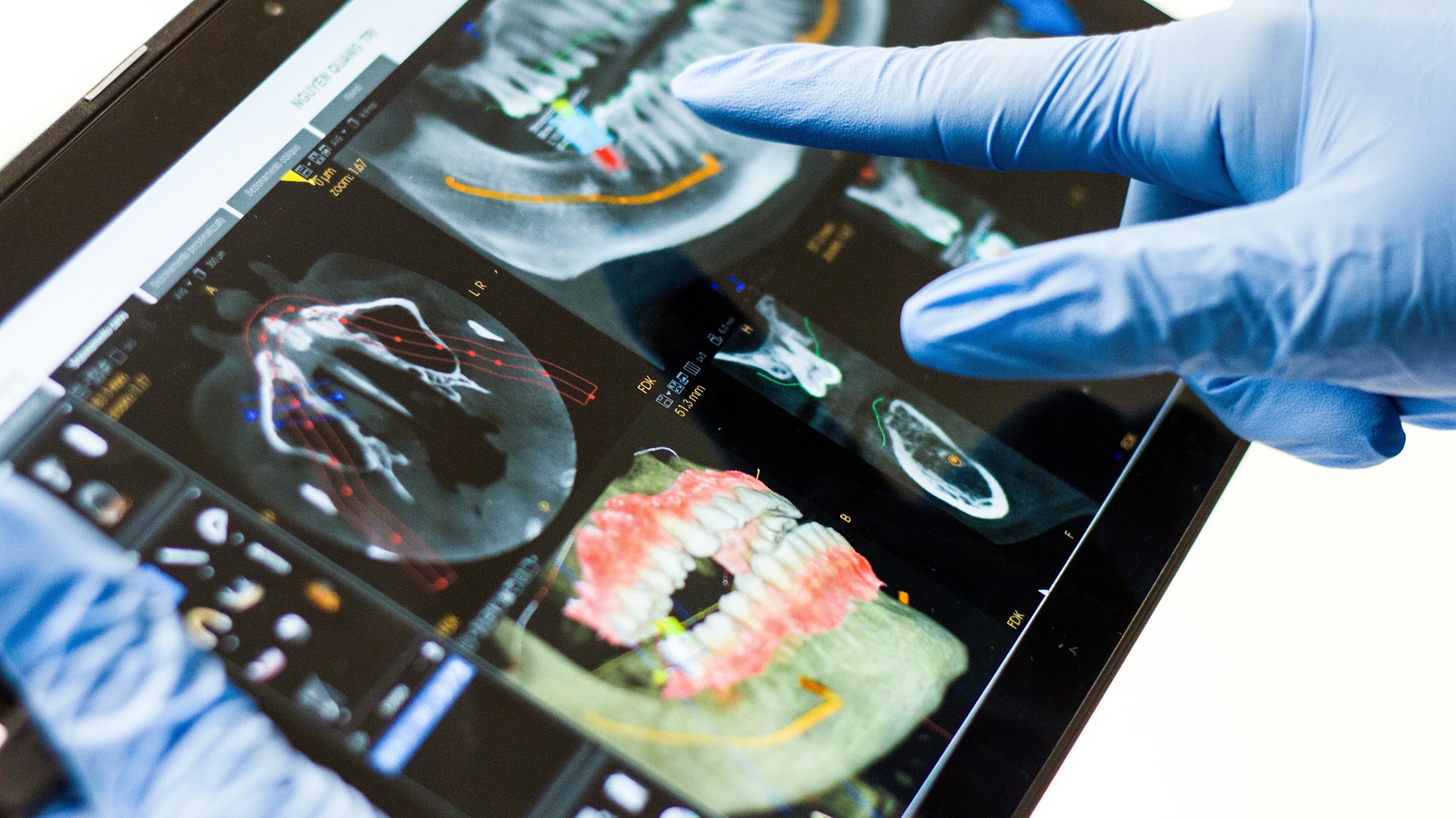 Photo Dentist Pointing To 3d Cbct Scan Of Jawbone