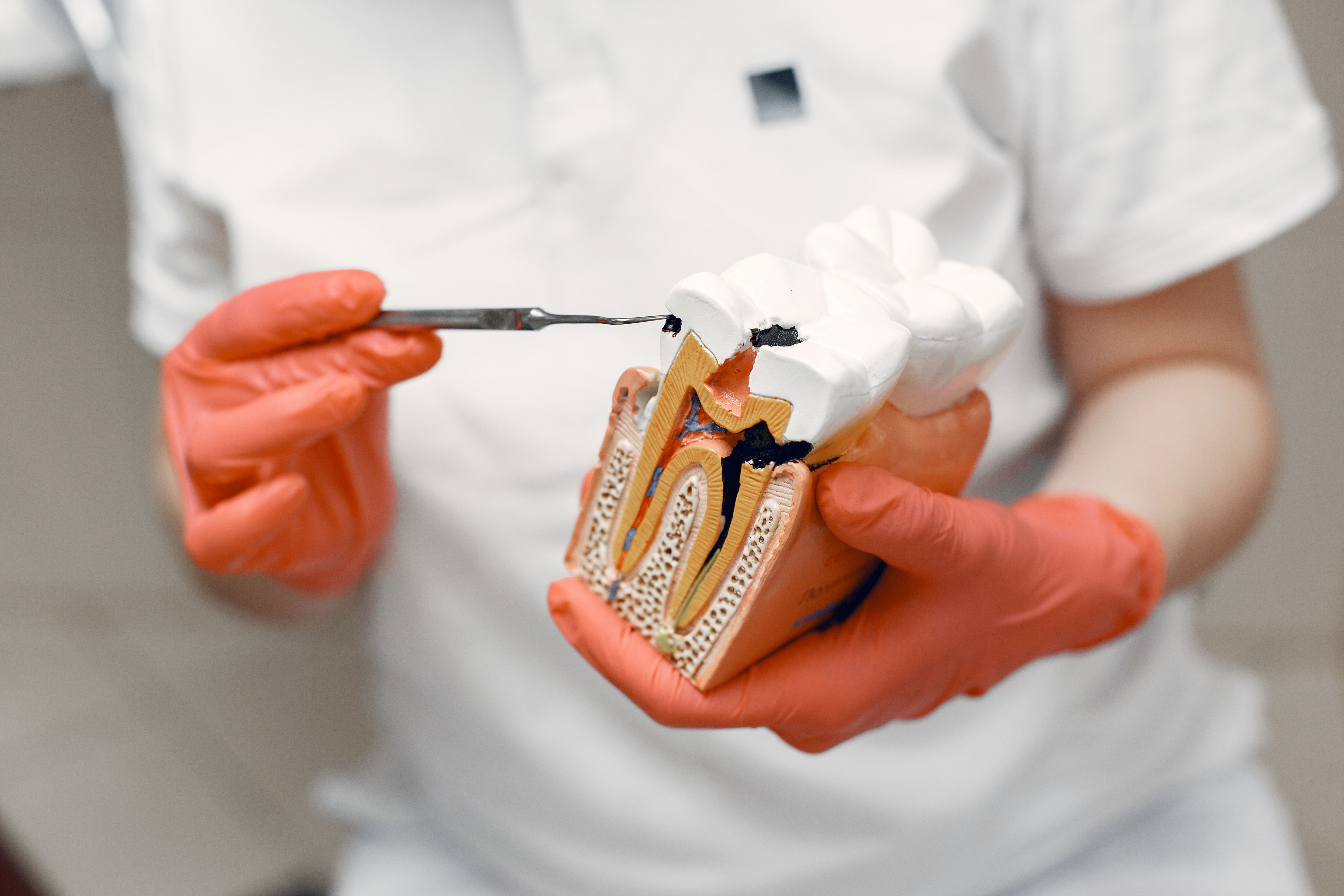 Photo Tooth Model Illustrating Is A Black Tooth An Emergency