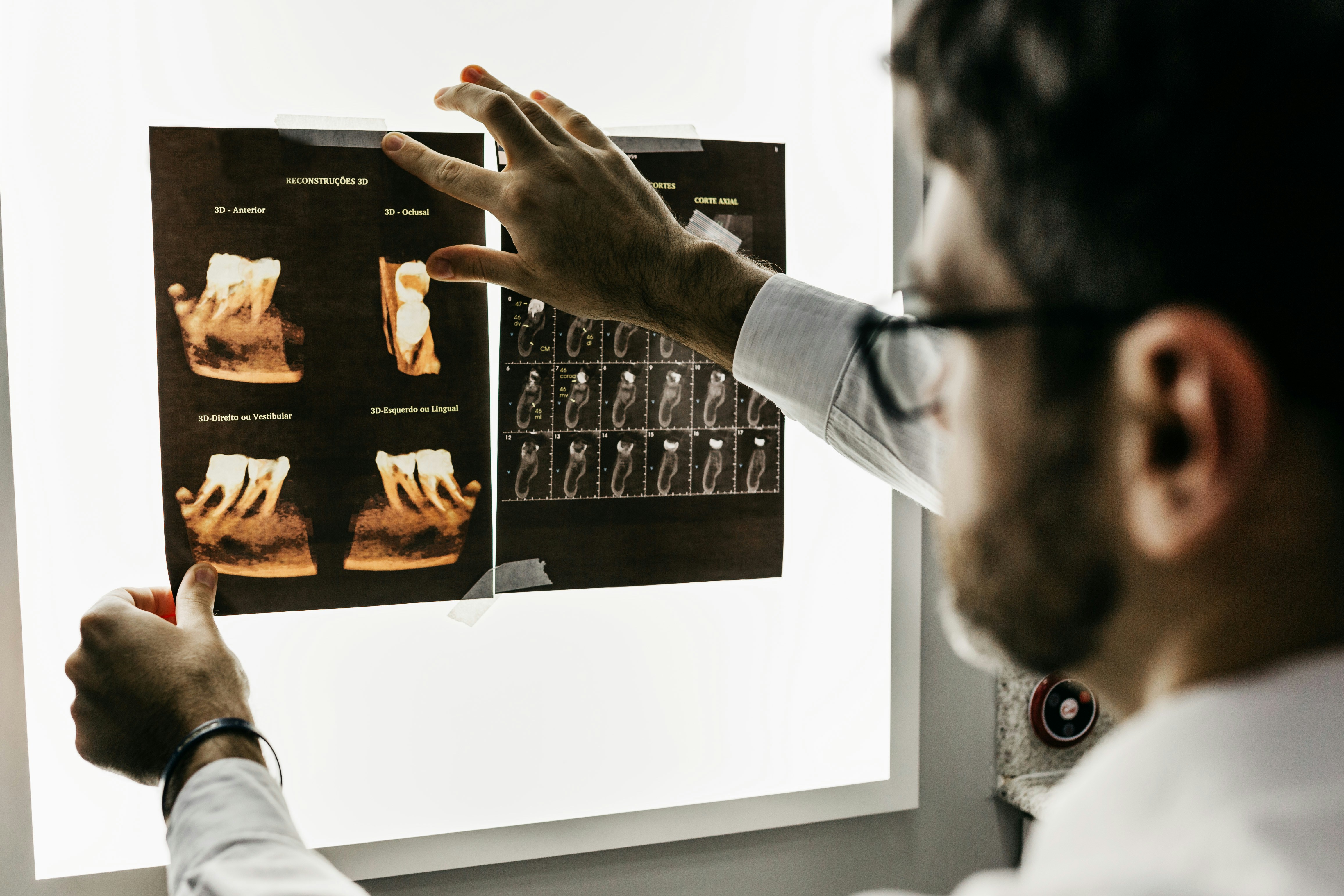 Photo Dentist Reviewing Dental Scans For Dental Implant Process Timeline