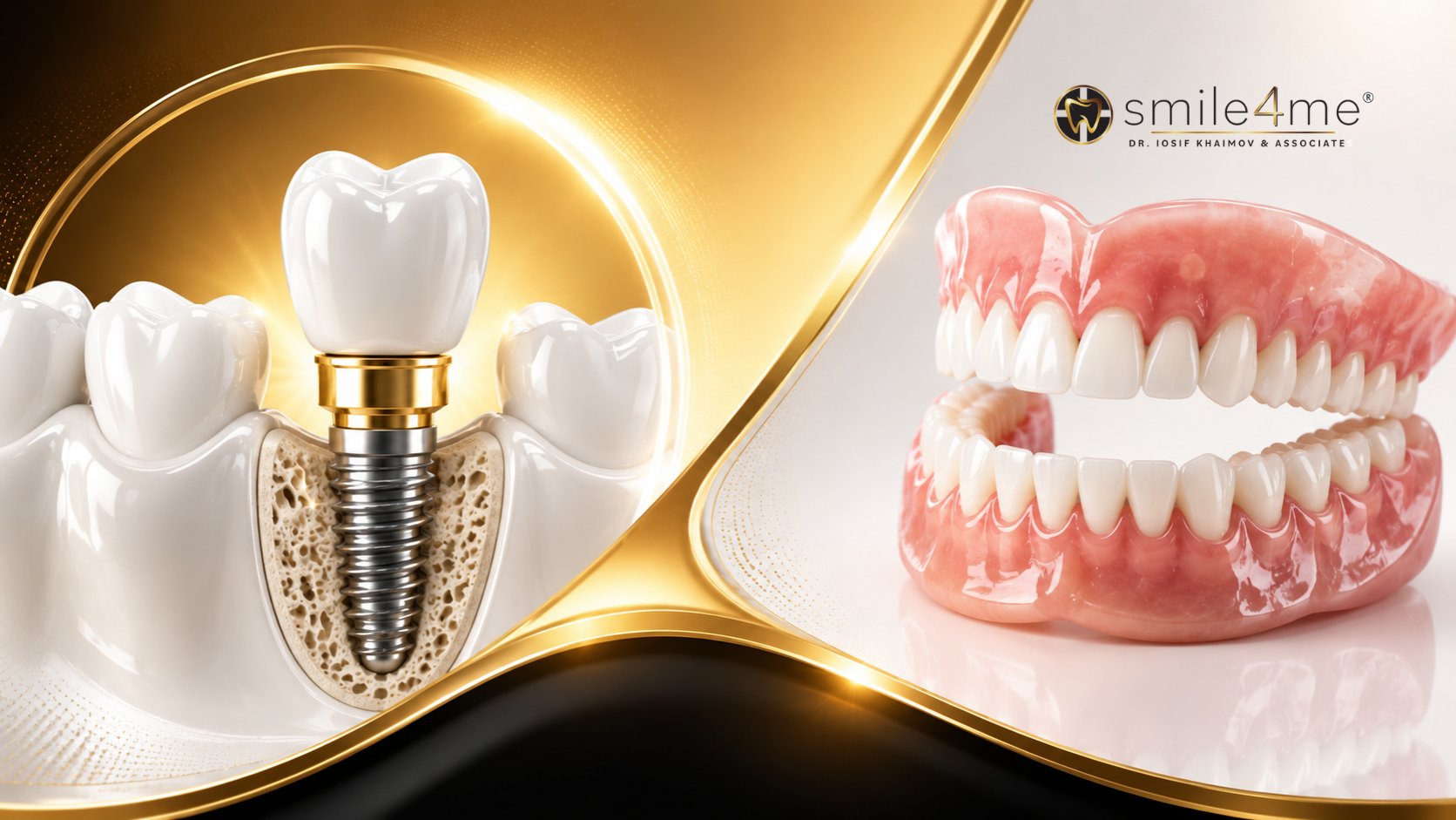 Photo Dental Implants For Seniors Beside Full Dentures Comparison Illustration