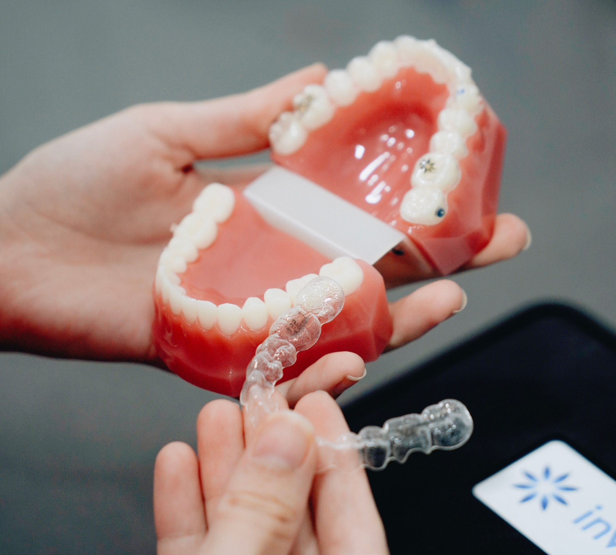 Photo Dental Models With Clear Aligners Showing How Often Are Invisalign Trays Changed