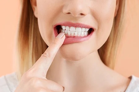 Photo Of Woman Pointing To Her Gums With Mouth Open Showing Teeth